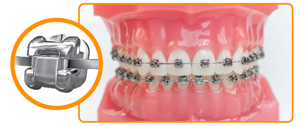 Mắc cài kim loại tự động