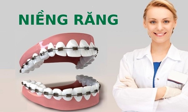 3 yếu tố ảnh hưởng trực tiếp đến giá cả của việc niềng răng