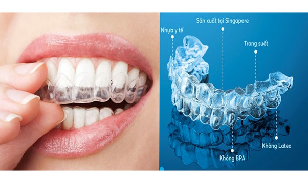 Bộ niềng răng cho người lớn