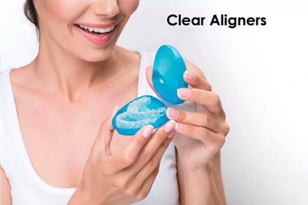 Niềng răng 3D Clear